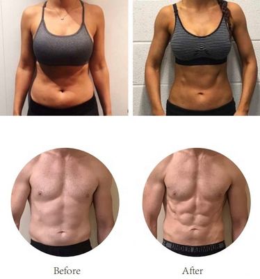 La machine de forme physique d'OEM SME sculptent l'équipement, les cellulites et la grosse machine de réduction