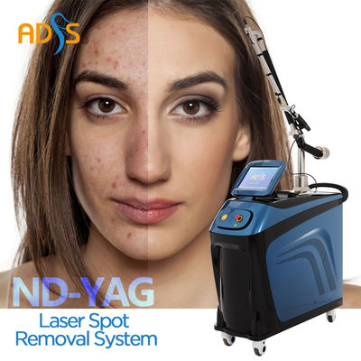 machine de laser de ND YAG de 1064nm 532nm 755nm pour l'enlèvement de pigmentation