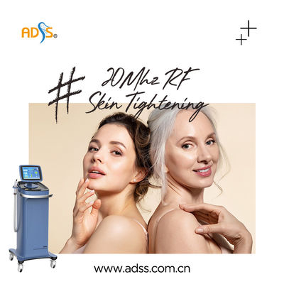 Peau serrant la machine 20MHz de Thermage rf pour le message publicitaire